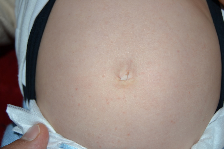 Про двойняшковые пупы ))