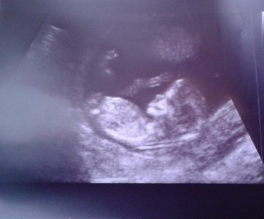 Первый скрининг прошел на ура!!!!