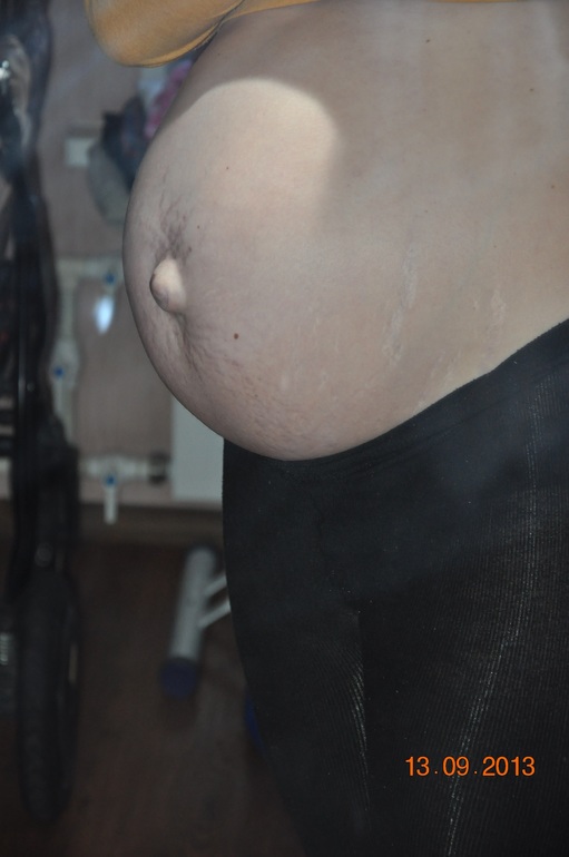 Пузо большое для моего срока или нет?